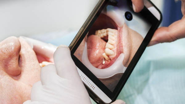 The Role of Photos in Orthodontics for Dental Recordkeeping
